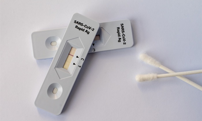Antigenní test na SARS COVID-19